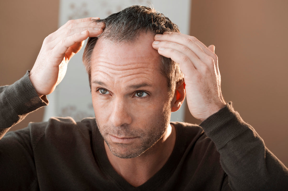 Man examining receding hairline at the temples