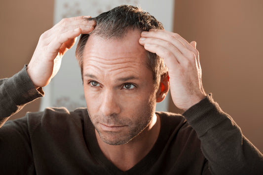 Man examining receding hairline at the temples