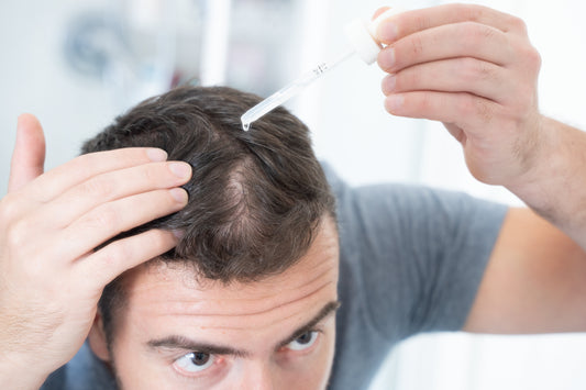 How to Apply Topical Hair Loss Medication: A Step By Step Guide