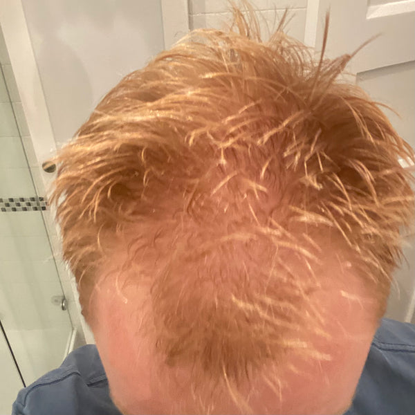 Before treatment