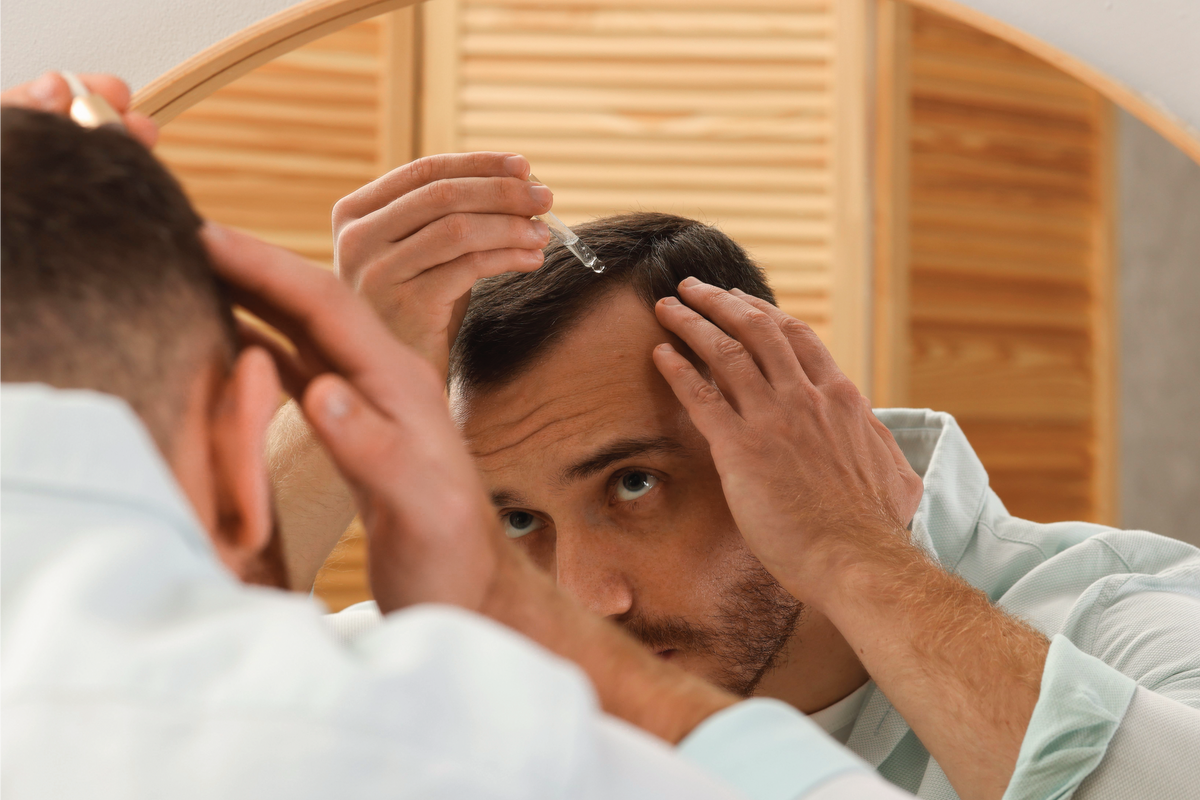 Man applying a topical hair loss treatment in front of a mirror.