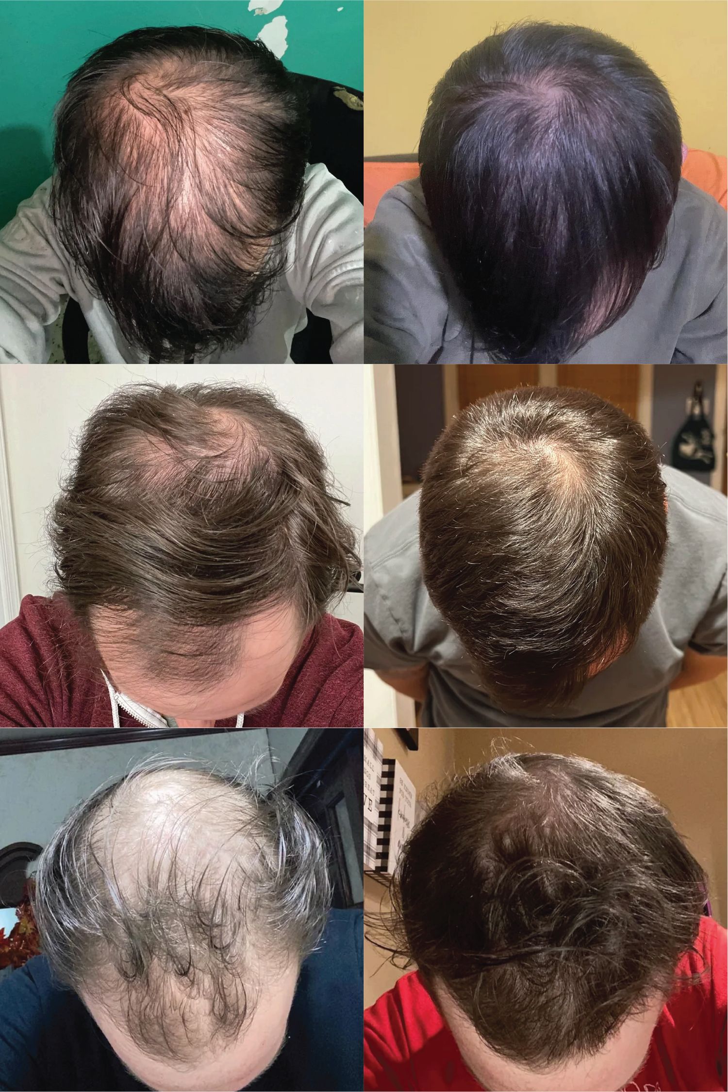 Example results for oral and topical hair loss prescription treatments.