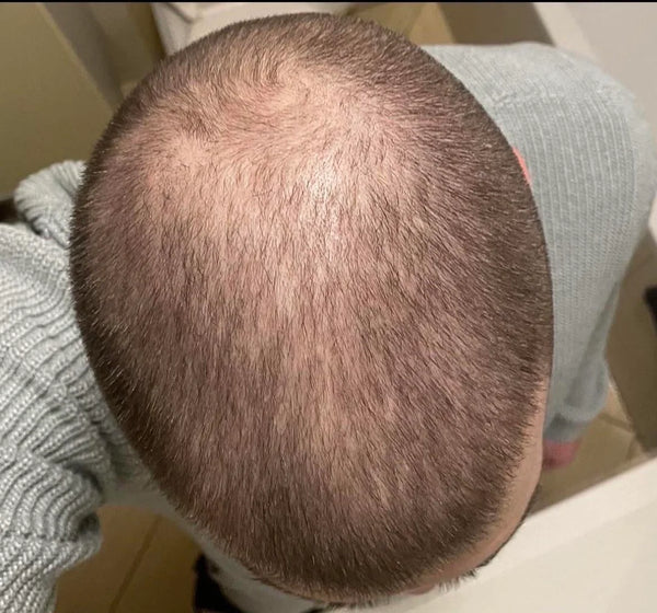 Before treatment