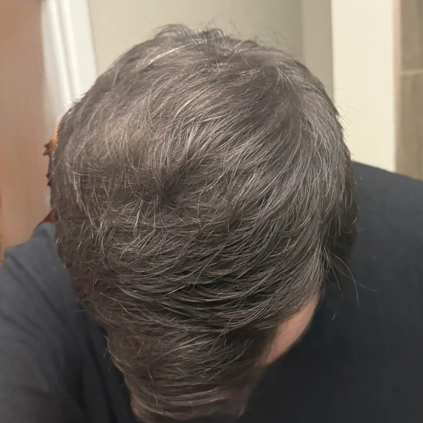 After treatment
